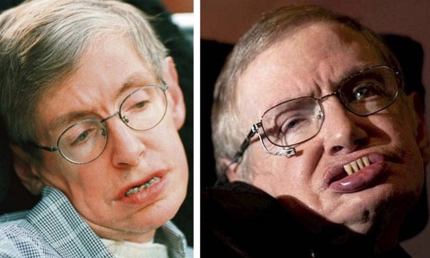 Stephen Hawking’s Mysterious New Teeth